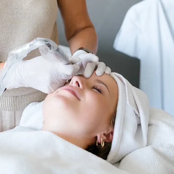 Der Microneedling-Pen wird über die Stirn einer Kundin geführt.